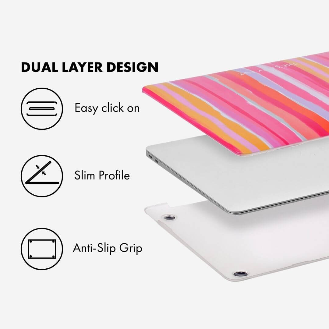 Gelato Stripe Macbook Case 