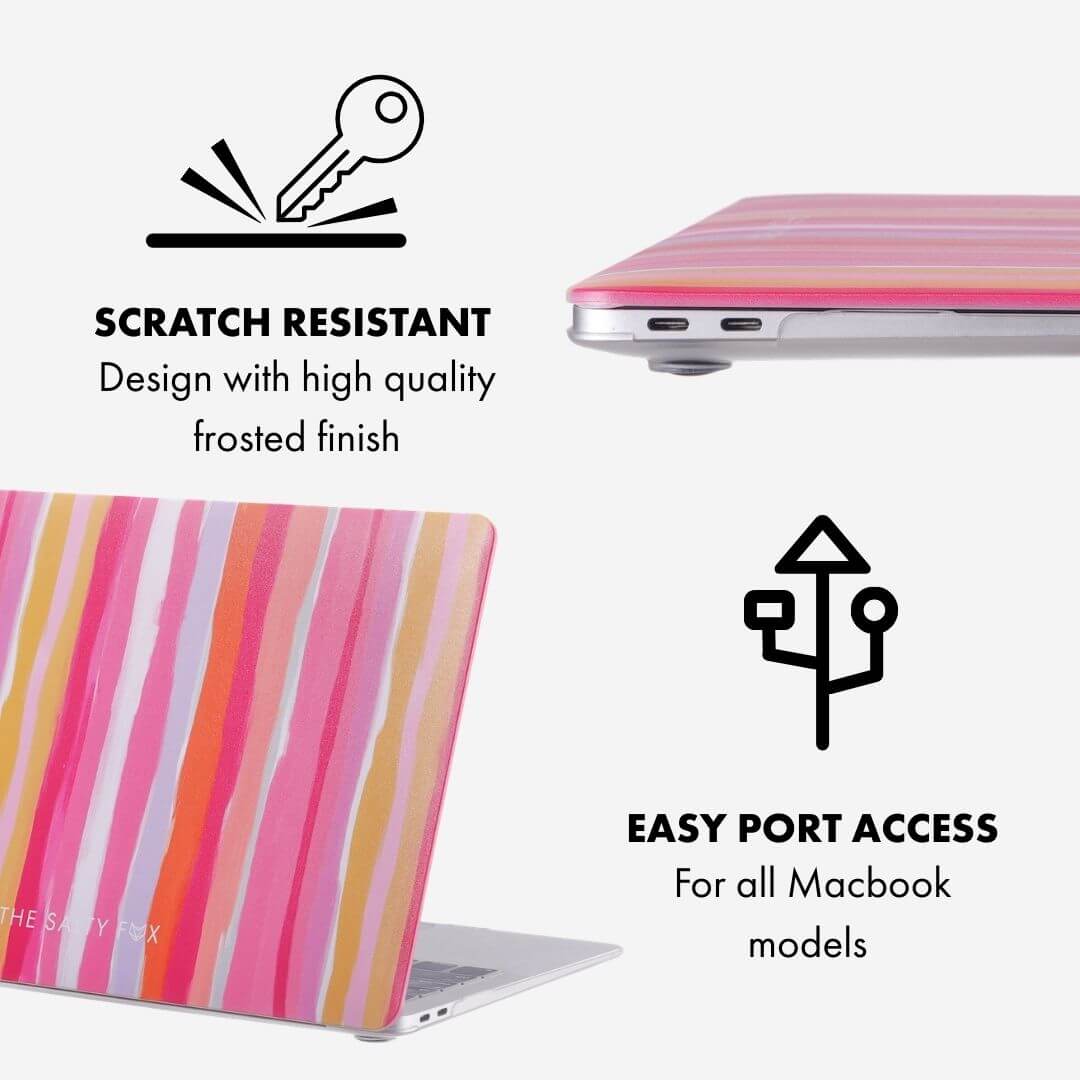 Gelato Stripe Macbook Case 